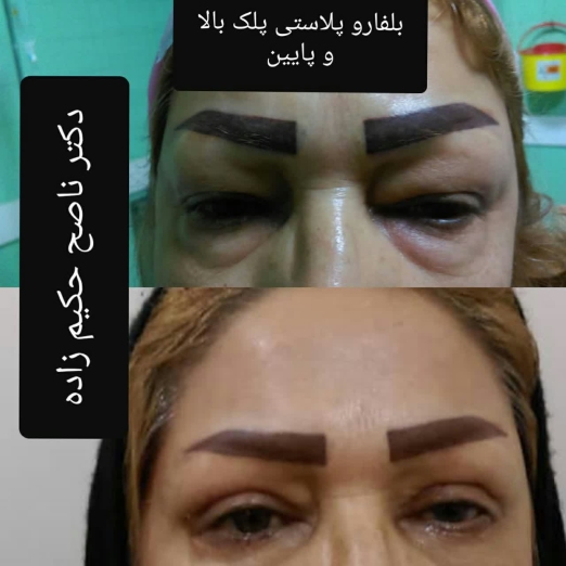 دکتر ناصح حکیم زاده جراح و متخصص بیماری های چشم در خرم آباد