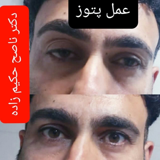 دکتر ناصح حکیم زاده جراح و متخصص بیماری های چشم در خرم آباد
