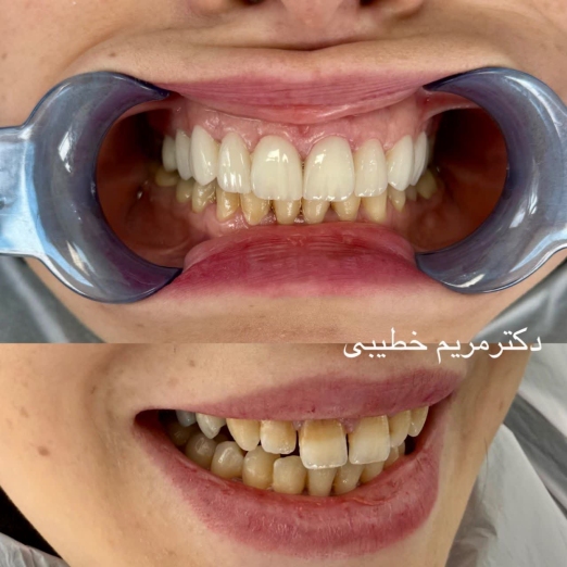 دکتر مریم خطیبی جراح دندانپزشک در تهران