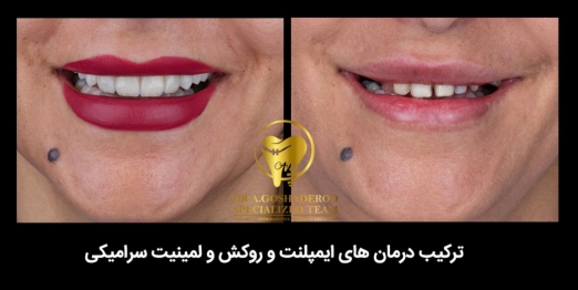 دکتر عزیز گشاده رو