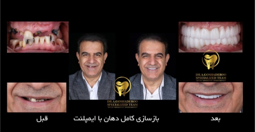 دکتر عزیز گشاده رو