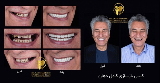 دکتر عزیز گشاده رو