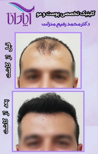دکتر محمد رفیع منزلت