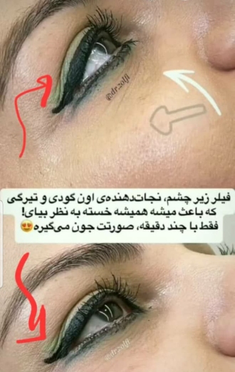 کلینیک زیبایی پوست ،مو و لیزر دکتر زلفی