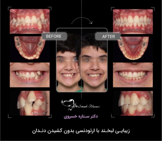 نمونه درمان
