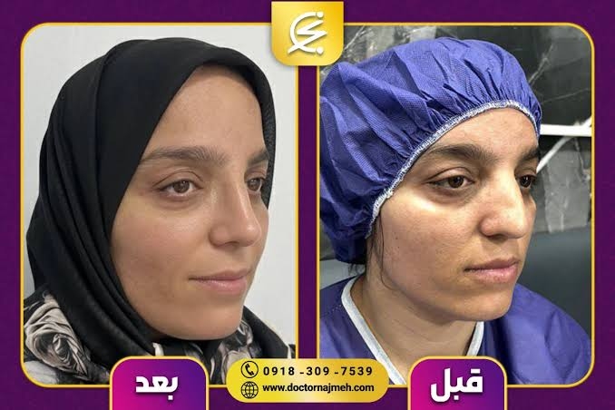 بهترین جراح بینی در کرمانشاه | راهنمای انتخاب جراح بینی + معرفی دکتر نجمه برخورداری