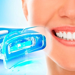 انواع بلیچینگ دندان + مزایا، معایب و مراقبت های بعد از آن