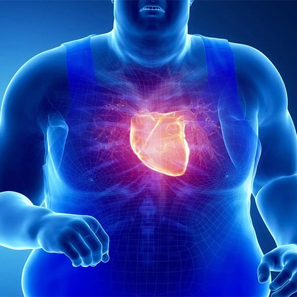 تاثیر چاقی بر قلب و بهترین روش های پیشگیری از چاقی و سکته قلبی
