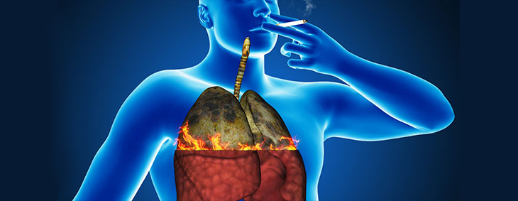 اثرات نامطلوب سیگار بر بدن