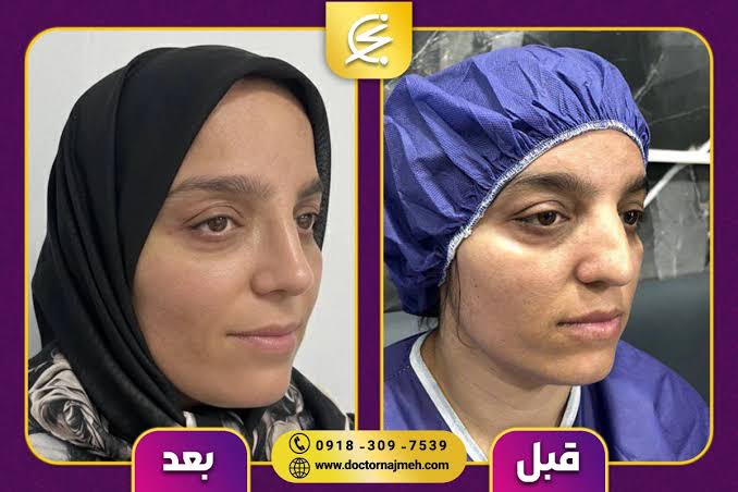 بهترین جراح بینی در کرمانشاه 